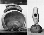 Links is het verschil te zien tussen een schedel van een paleolithische mens, en van een indianenschedel neolithische mens ( na Columbus )